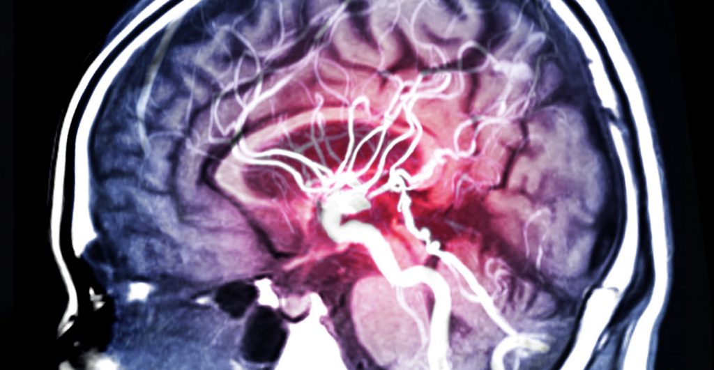How This AI System Can Predict Seizures